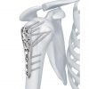 3.5 mm LCP Proximal Humerus Plate