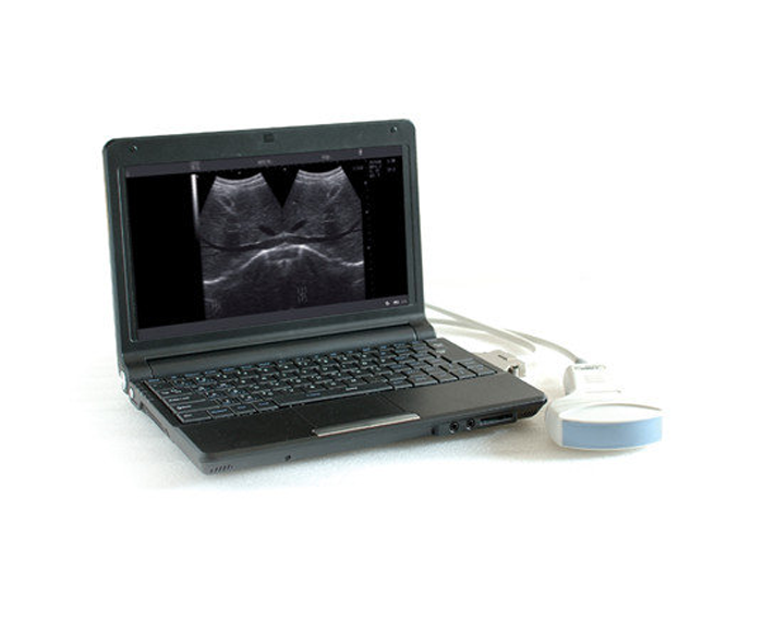 سونوگرافی XUZHOU CX6100 B