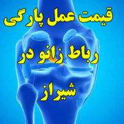 قیمت عمل رباط صلیبی زانو در شیراز