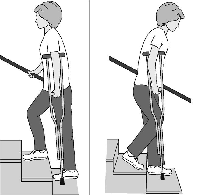 بالا و پایین رفتن از پله ها بعد از عمل تعویض مفصل زانو