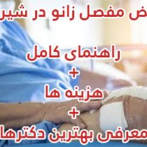 Knee_replacement تعویض مفصل زانو در شیراز