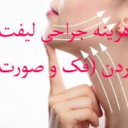 هزینه جراحی لیفت گردن