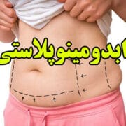 هزینه جراحی ابدومینوپلاستی (تامی تاک) | 1401