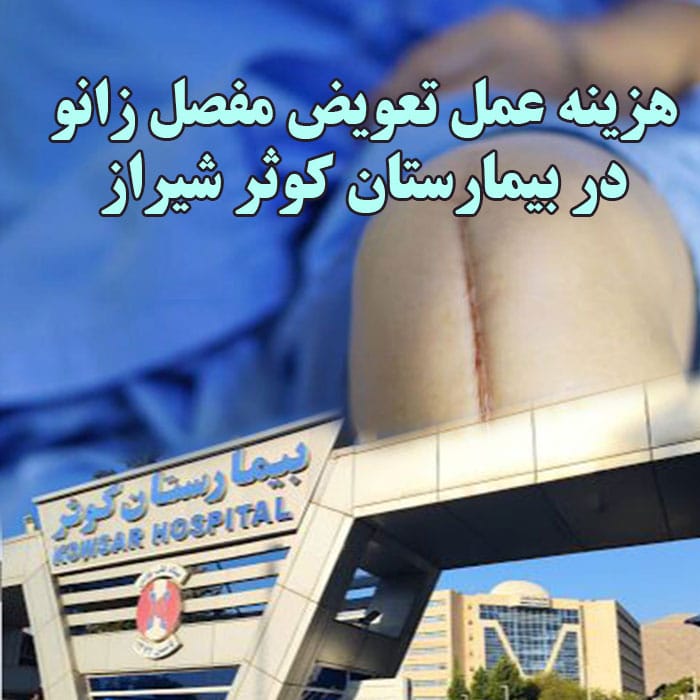 هزینه عمل تعویض مفصل زانو در بیمارستان کوثر شیراز